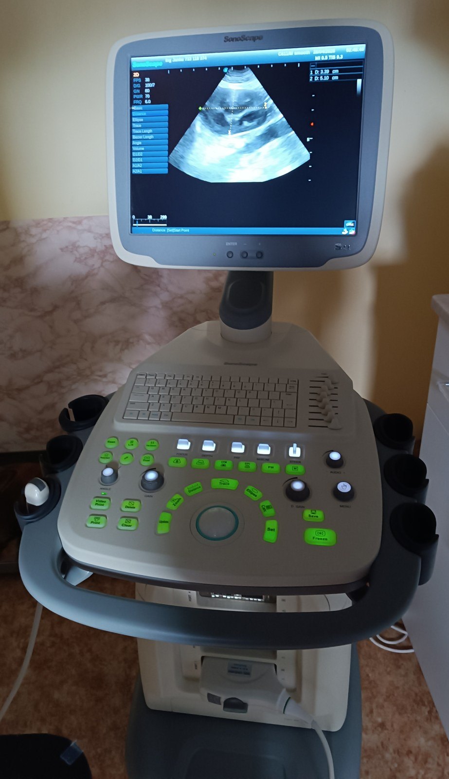 Diagnostický ultrazvuk